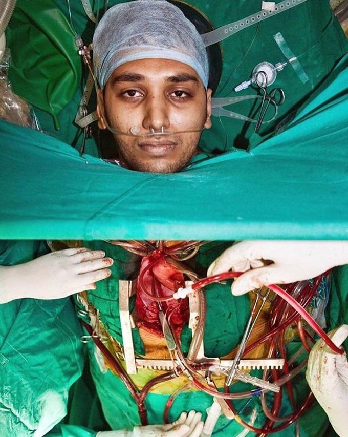 Open heart surgery