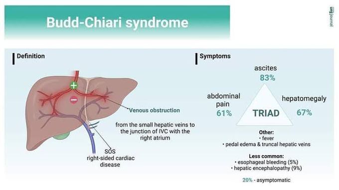 Budd-Chiari Syndrome