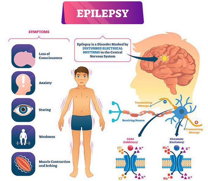 Symptoms of epilepsy