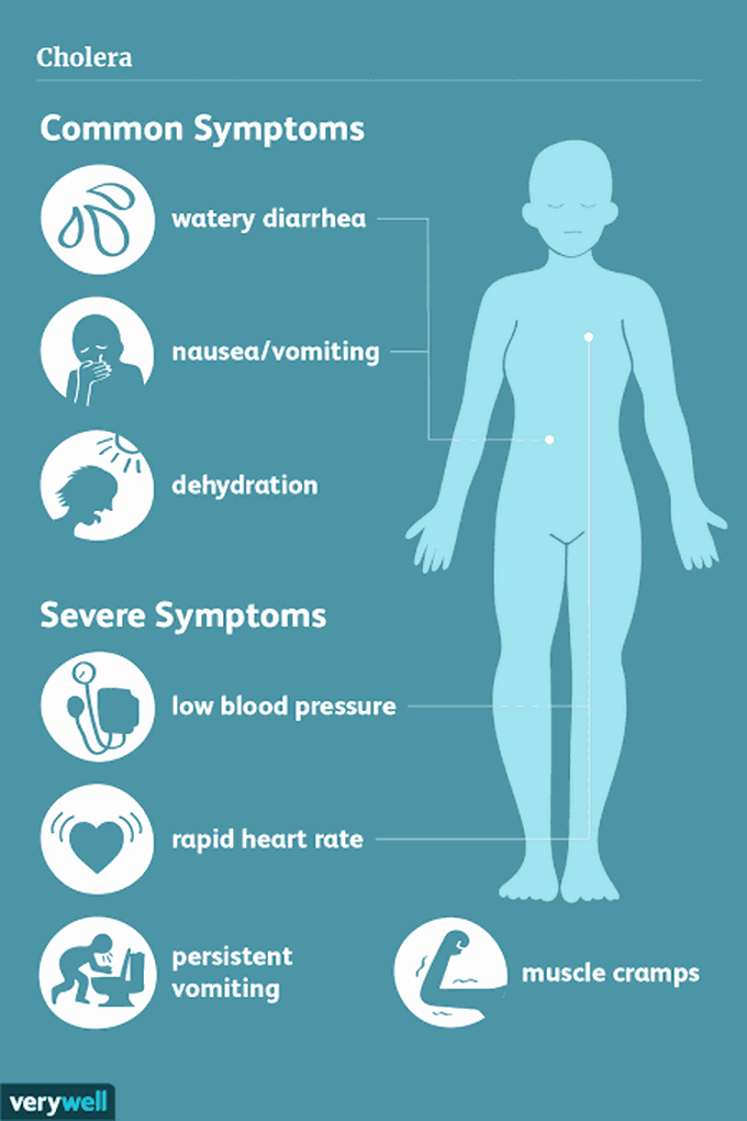 Cholera symptoms