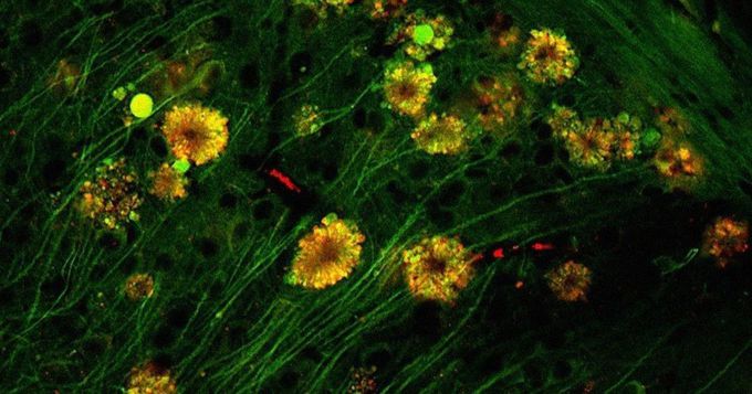 Flowers in the brain