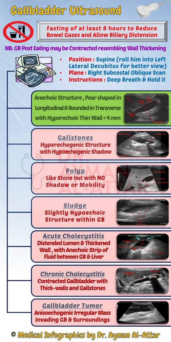 Gall bladder Ultrasonogaphy