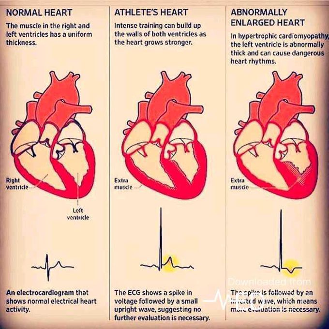 Ecg formation