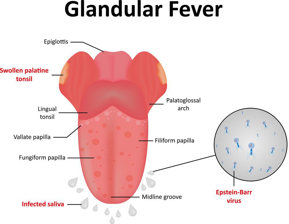 Glandular Fever Test Results How Long