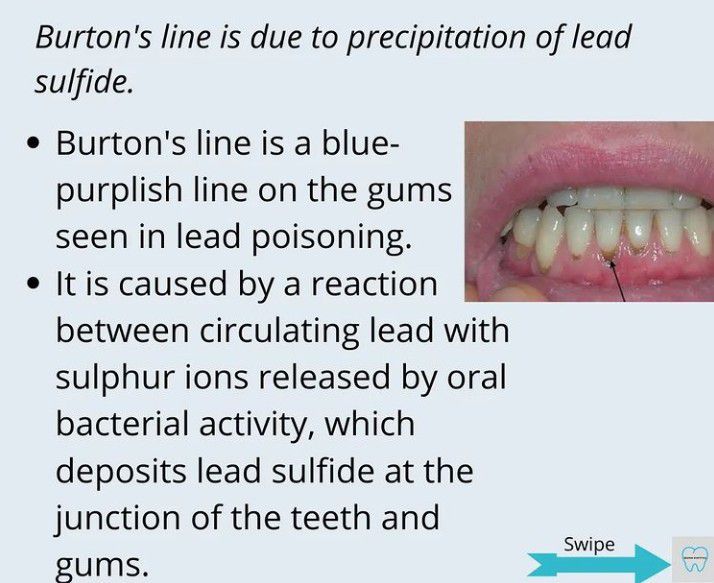 Burton s Line MEDizzy