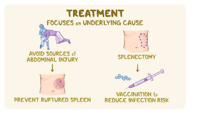 Treatment of Splenomegaly