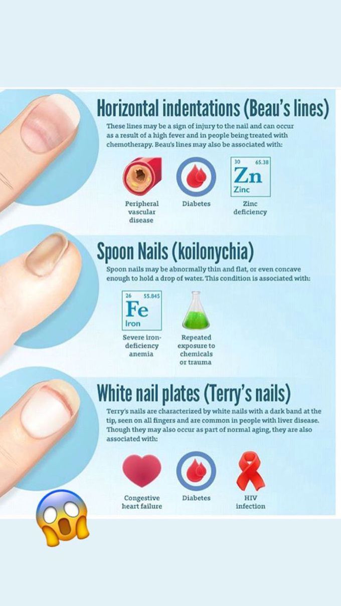 What your fingernails say about your health ?🖐🏻🧐 (part 2)