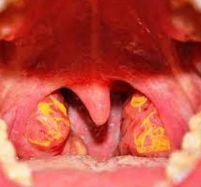 Diagnose it
