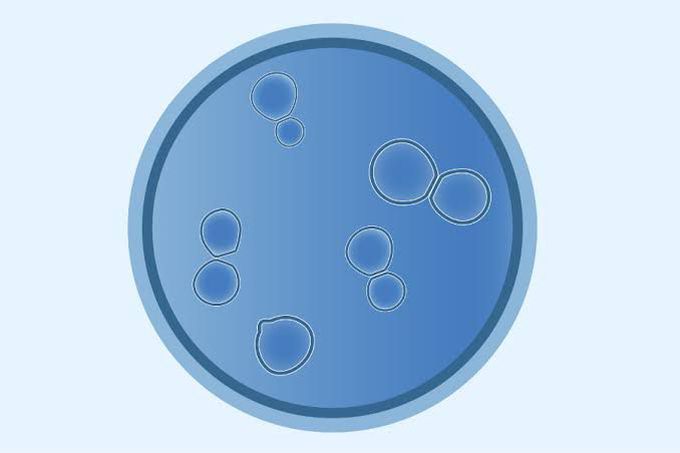 Blastomycosis