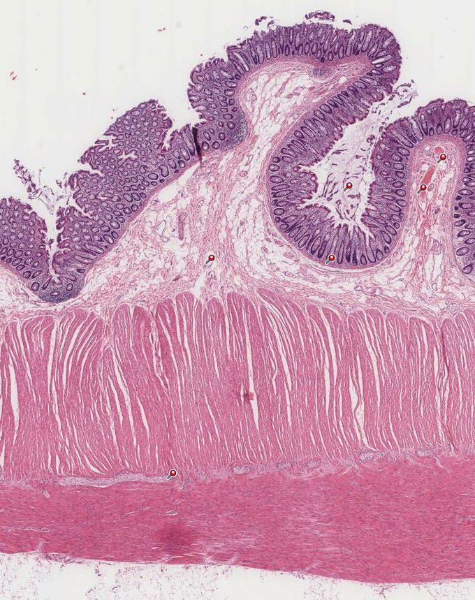 Colon wall