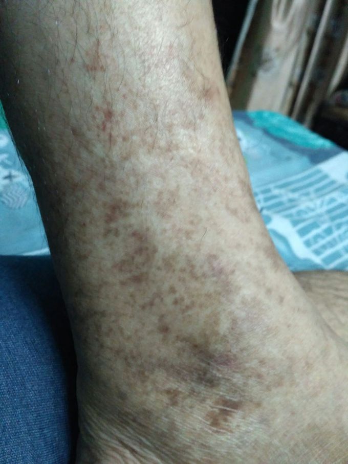 Possible diagnosis?