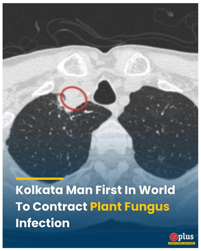 Plant fungus Infection