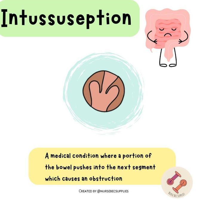 Intussusception