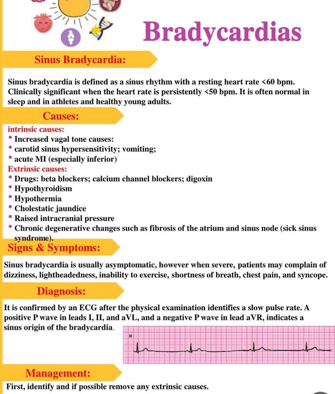 Bradycardias