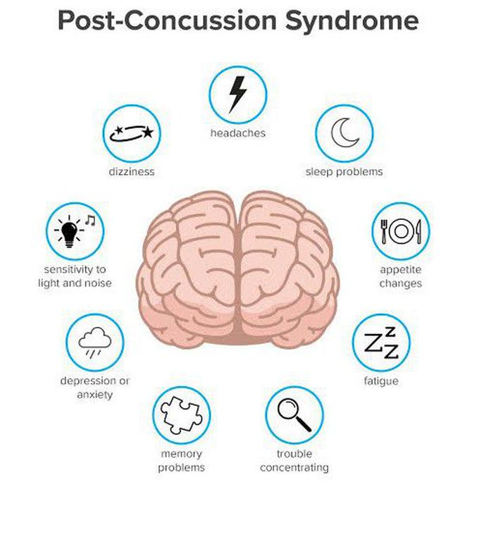These are the symptoms of Post Concussion syndrome