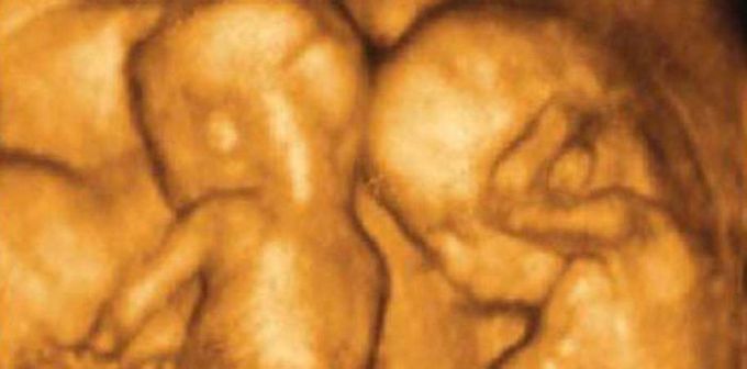 When she decided not to abort twins, the abortion facility locked her inside
