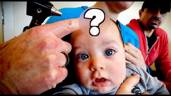 CUTE BABY with a BULGING FONTANELLE (Extremely Rare)