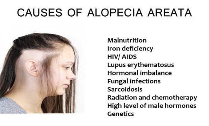 Causes of alopecia