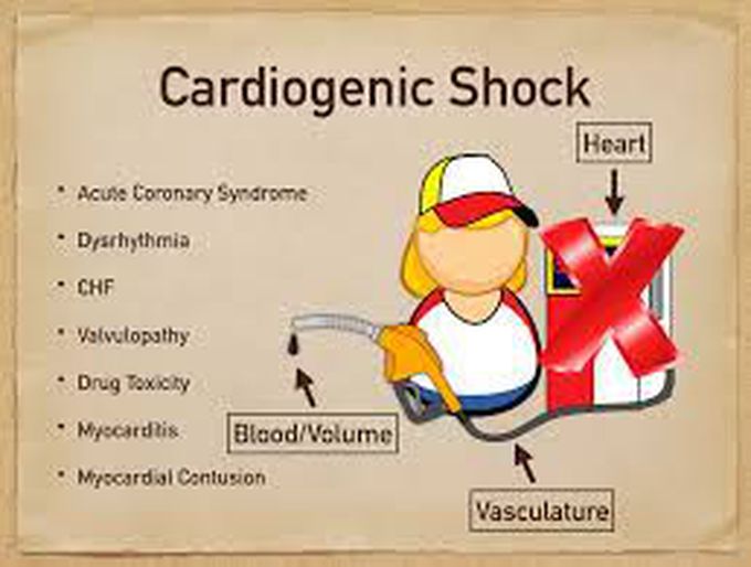 Treatment for cardiogenic shock