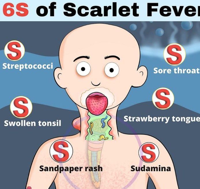 Understanding Scarlet Fever: Causes, Symptoms & Treatment — Eightify