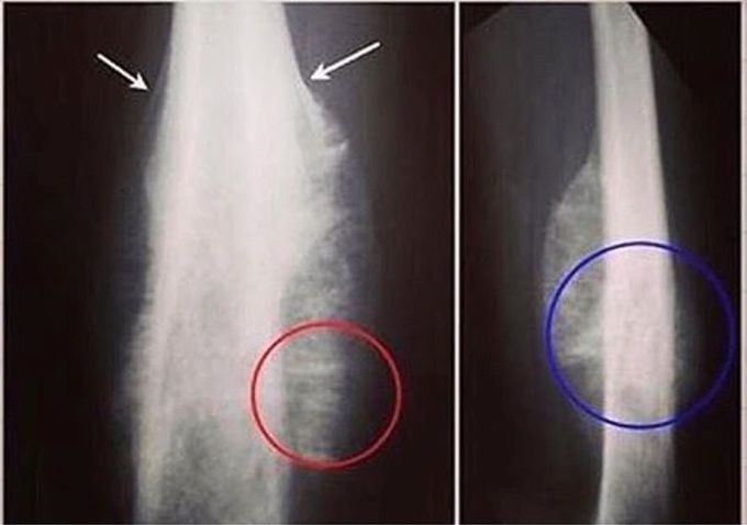 Whts the diagnosis doctorss ? 👨‍⚕️👨‍⚕️