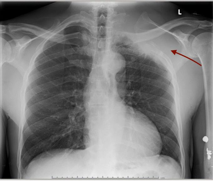 Diagnosis?