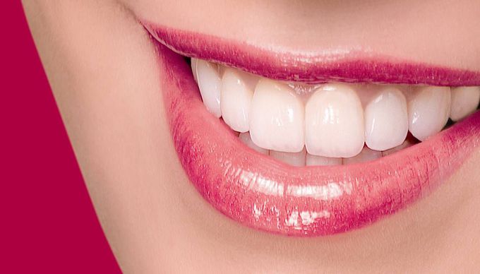 Dental Smile ☺
