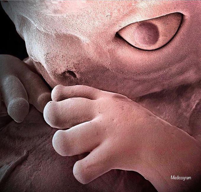 Stunning coloured scanning electron micrograph (SEM) of an eight week old human foetus