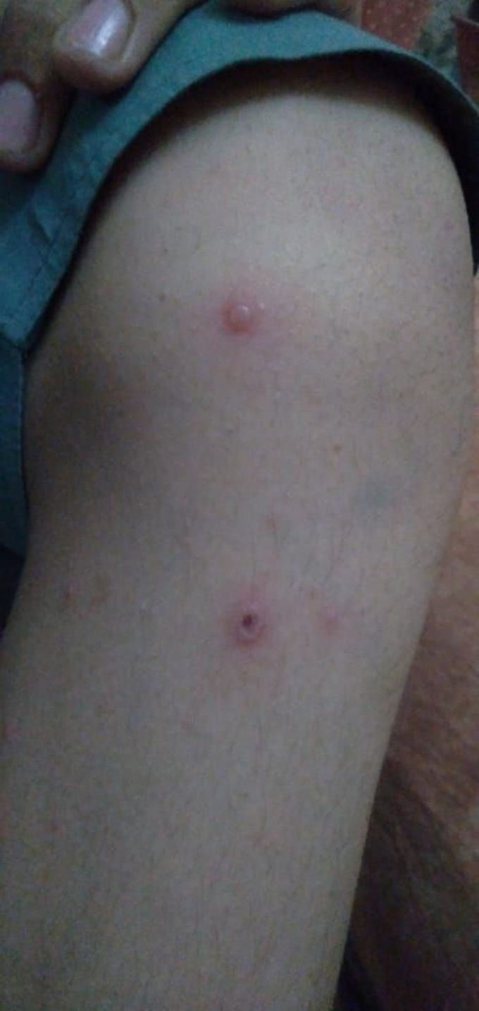 Diagnose please.