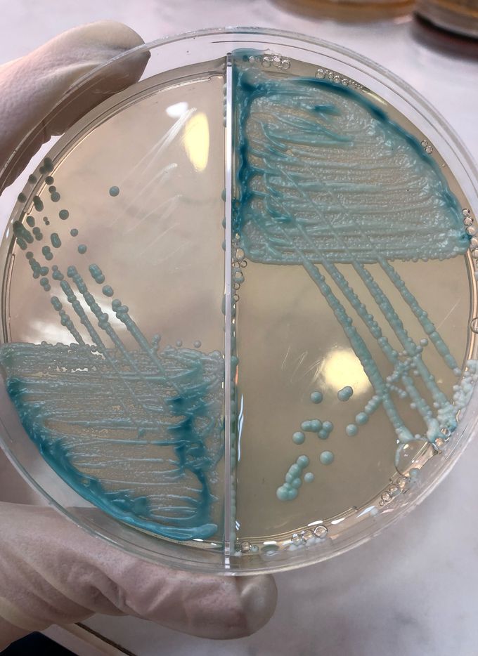 İdentification of Candida species on Chromatic ™ Candida agar: Green-blue color - Candida tropicalis