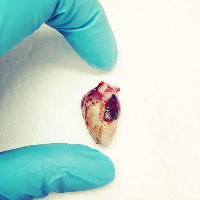 20 weeks fetal heart 