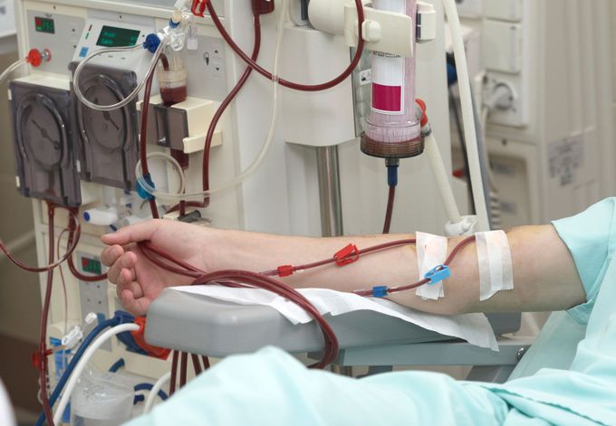 Complications of Dialysis