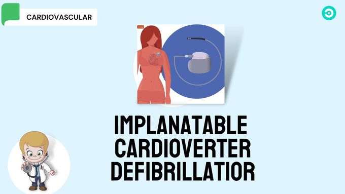 ICD: Implantable Cardioverter Defibrillator
