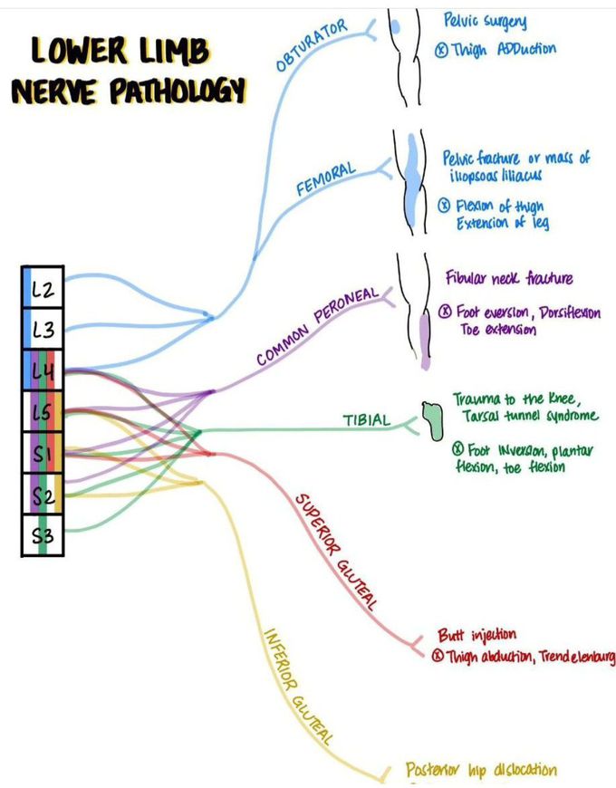 Lower Limb Nerve Pathology