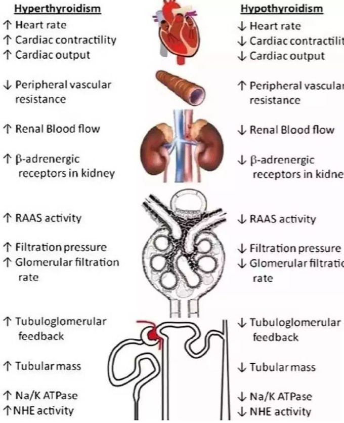 Hypothyroidism Vs Hyperthyroidism