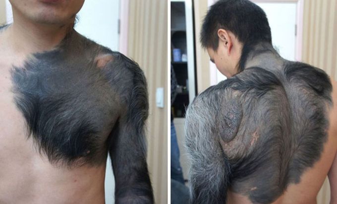 Giant Furred Moles