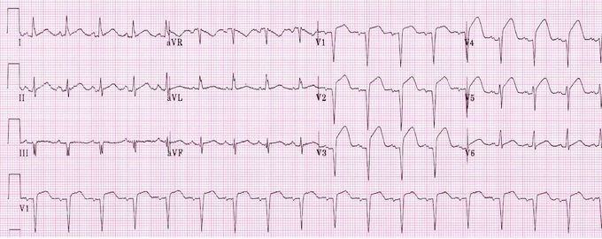 Name the vessel involved in this case??