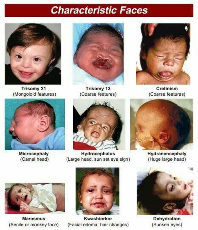 It's all about face...