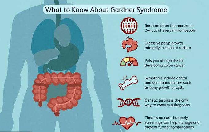 Gardner's syndrome