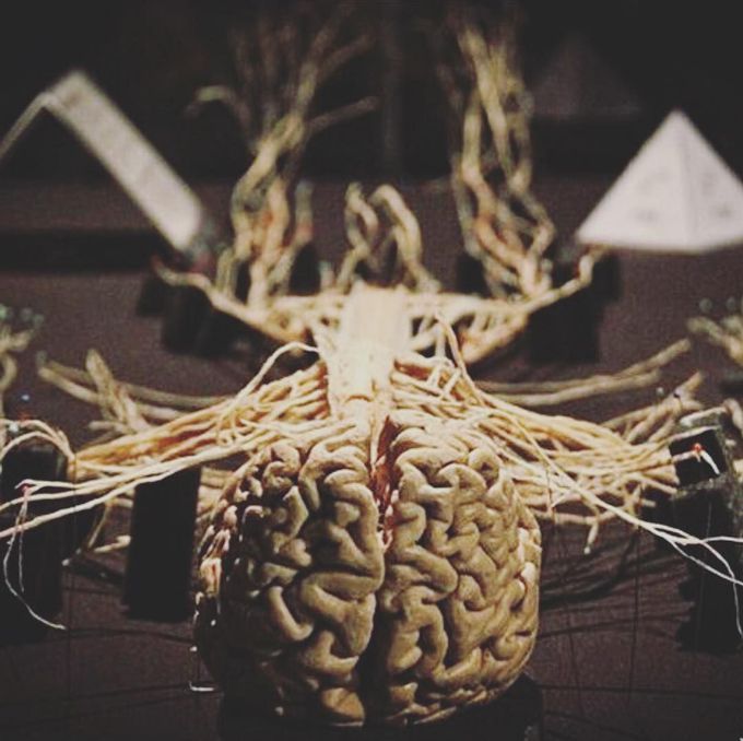 Dissected central nervous system