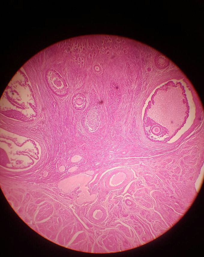 Identify this microscopic structure