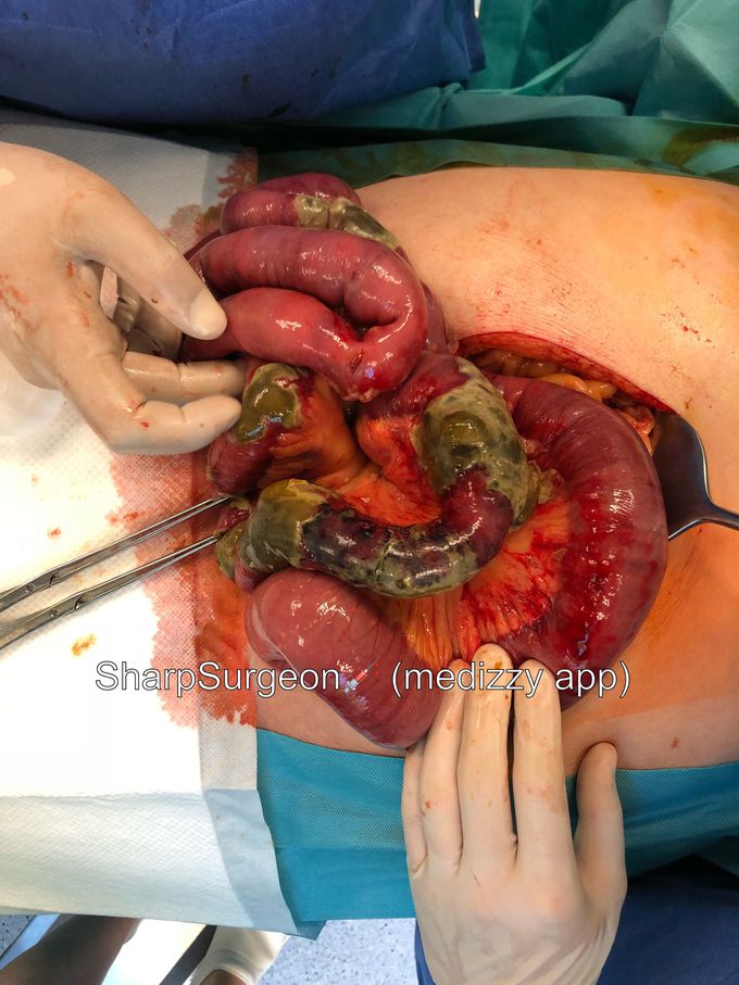 Hello all after long break! 👋🏻😃 For the beginning- can you spot the diagnosis? 🤔🙋🏼‍♂️