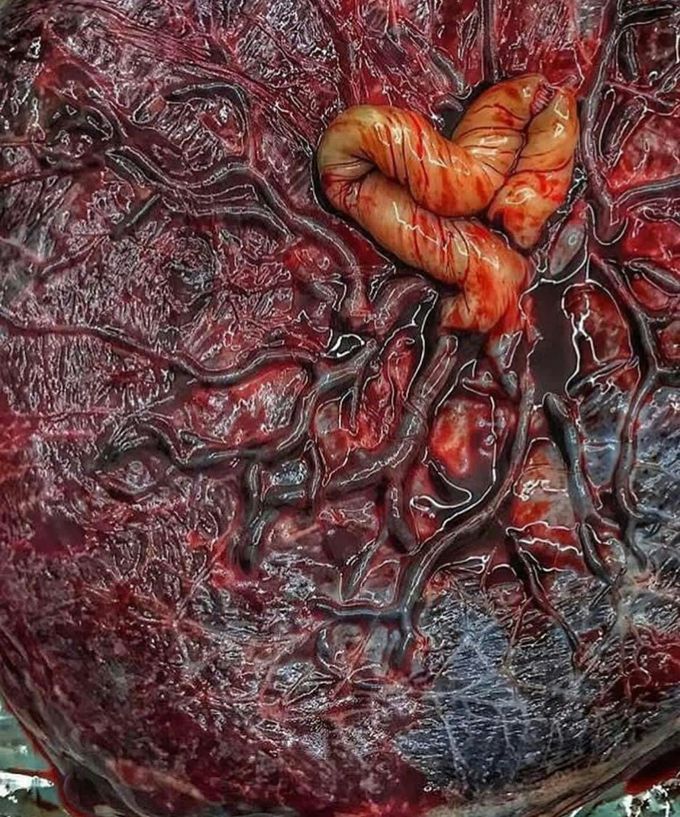 Placenta