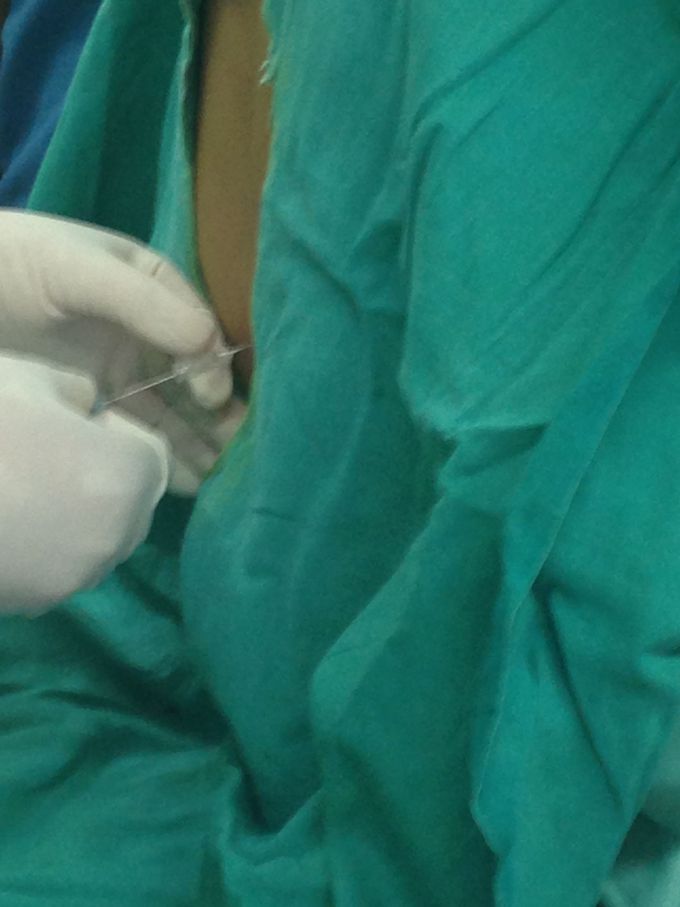 Anaesthesia quiz
