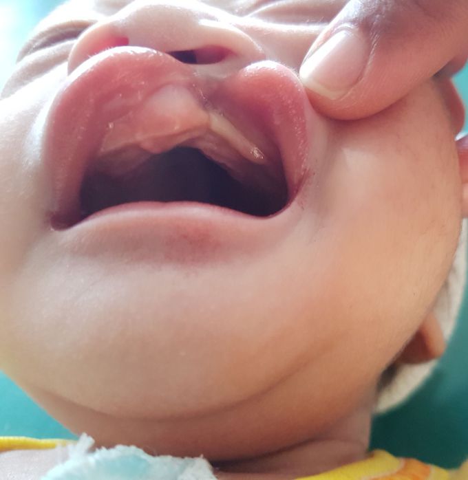 What is etiology ?