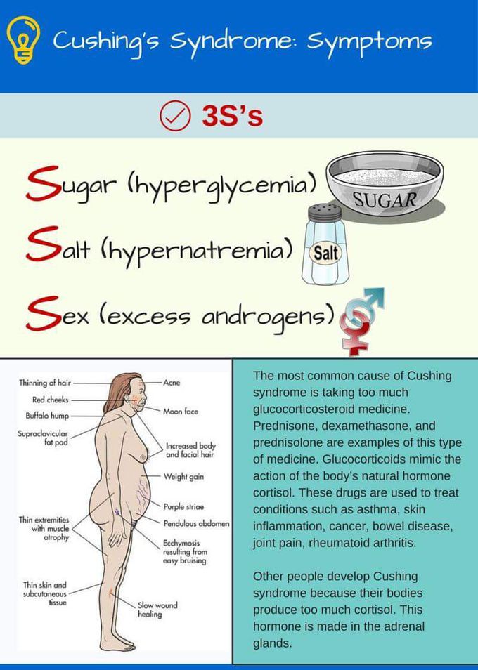 hypernatremia mnemonic