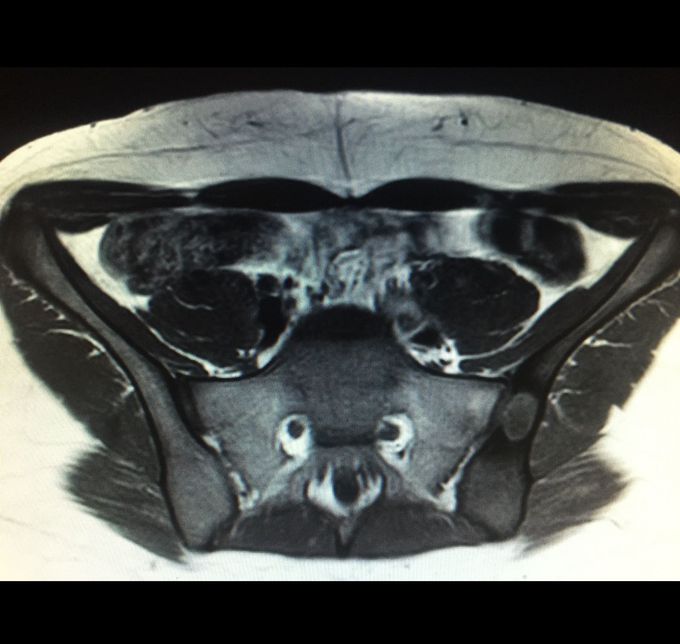What is The diagnosis?