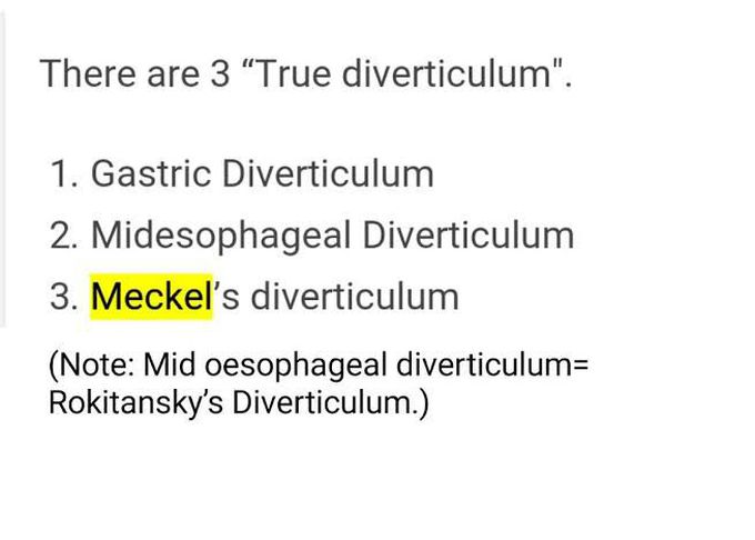 Types of  Diverticulum