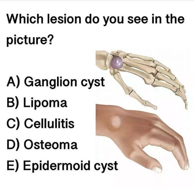 Identify the Lesion