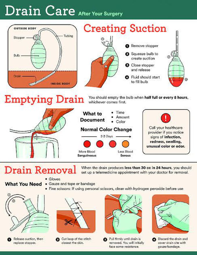 How surgical drain works MEDizzy